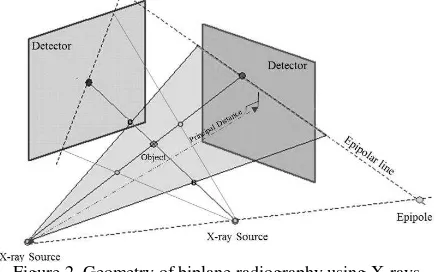 Figure 2. Geometry of biplane radiography using X-rays 