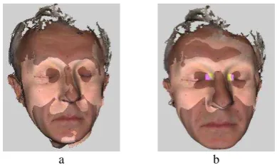 Figure 12. Two 3D models obtained in different conditions: (a) patient is seating, (b) patient is lying down