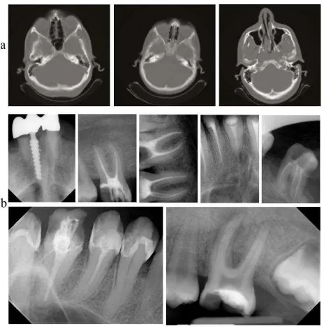 Figure 1. Examples of medical images: a the computed 