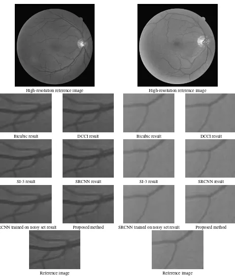 Figure 3. The result of retinal image upscaling.