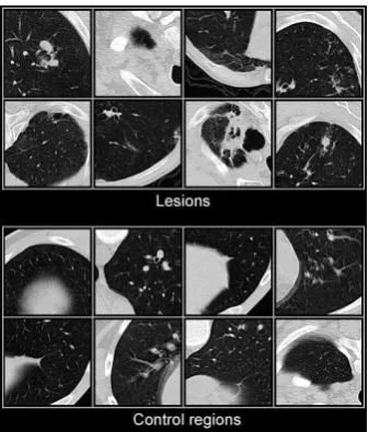 Figure 1. Example slices of manual 3D CT lesion labeling 