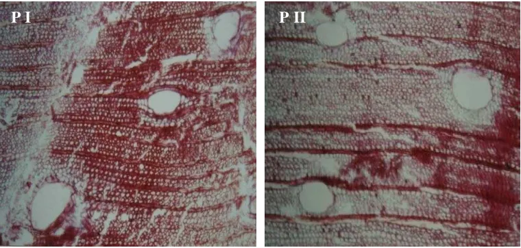 Gambar 10. Profil histokimia lignin kayu sengon dewasa yang dikoleksi dari Cibinong.  