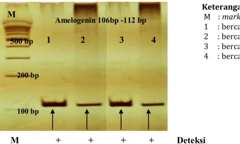 Gambar  4.  Visualisasi hasil PCR lokus Amelogenin 106 bp-112 bp pada bercak sampel 