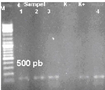 Gambar  1. Visualisasi hasil PCR 126 bp   Sekuensing 