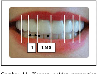 Gambar 11. Konsep golden proportionpada enam gigi anterior rahang atas30 