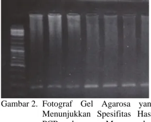 Gambar 2.  Fotograf  Gel  Agarosa  yang  Menunjukkan  Spesifitas  Hasil 