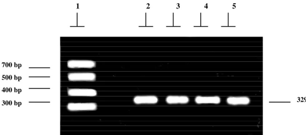 Gambar 2.  Fotograf dari gel agarose  dengan menunjukkan posisi lokus-2 gen hormon pertumbuhan menggunakan DNA ladder 20 - 5000 bp