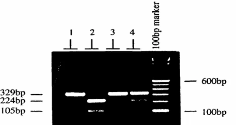 Gambar 2. Fotograf dari gel agarose memperlihatkan adanya polimorfisme DNA pada lokus 2 gen hormon 