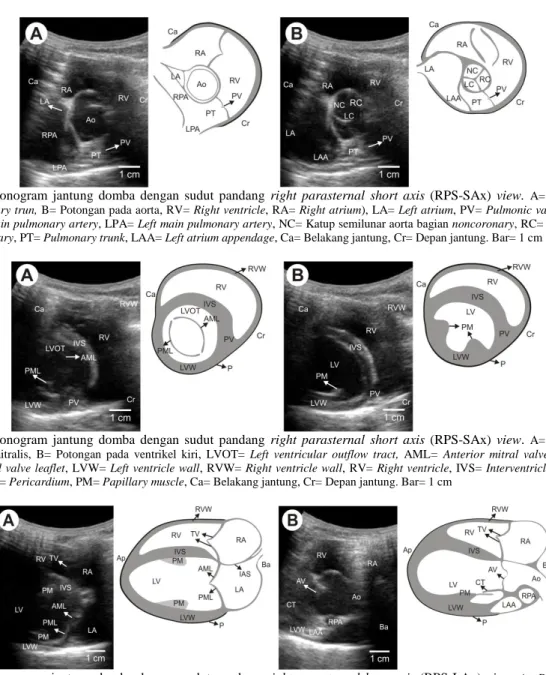 Gambar  3.  Sonogram  jantung  domba  dengan  sudut  pandang  right  parasternal  short  axis  (RPS-SAx)  view
