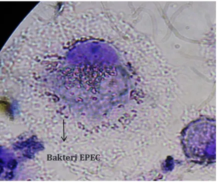 Gambar 1  Fagositosis EPEC oleh Makrofag        Dilihat dengan Mikroskop Cahaya        Perbesaran 1.000x