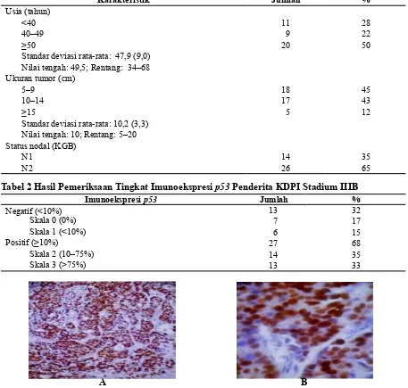 Tabel 2 Hasil Pemeriksaan Tingkat Imunoekspresi p53 Penderita KDPI Stadium IIIB