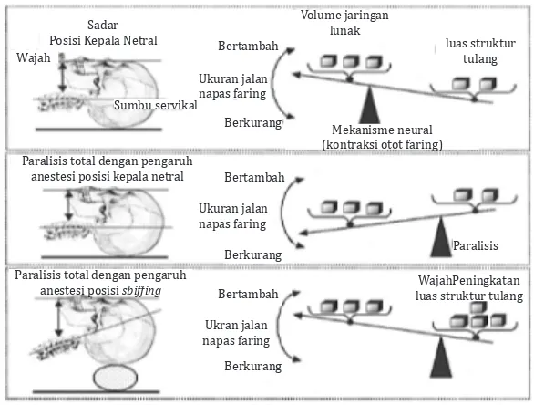Gambar 2 Interaksi antara Mekanisme Neural dan Anatomi Faring                     Dikutip dari: Townsend dkk.17