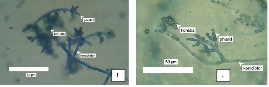 Gambar 3. Ciri mikroskopis isolat Trichoderma spp. SA9 (A) dan SA11 (B)Figure 3. Microscopic morphology of Trichoderma spp