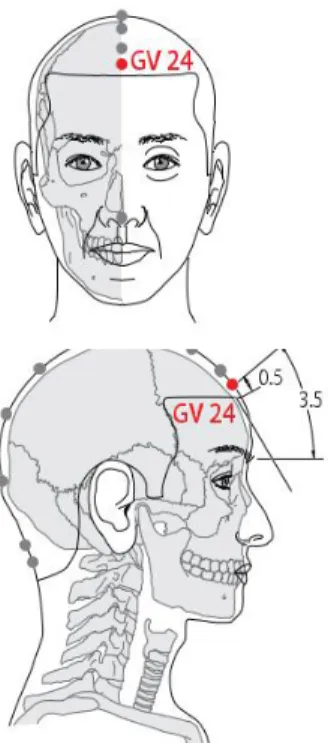 Gambar  2.2 Titik  Akupunktur  GV 24 (Shenting) (WHO, 2007) 