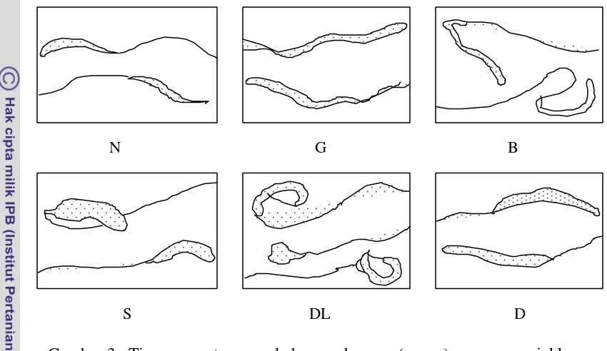 Gambar 3.  Tipe spermatozoa pada burung bangau (crane) yang menunjukkan 