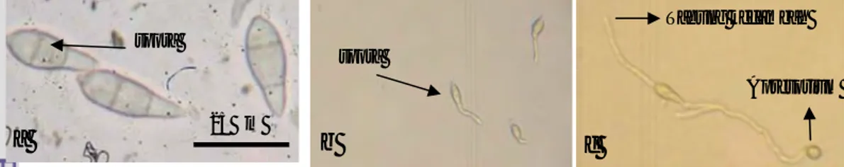 Gambar 1 (a) Spora P. grisea pada jam ke-0 setelah panen, perbesaran 10x40; (b) Spora mulai  berkecambah pada jam ke-4 setelah panen, perbesaran 10x10; (c) Apresorium mulai  terbentuk pada jam ke-6 setelah panen, perbesaran 10x10