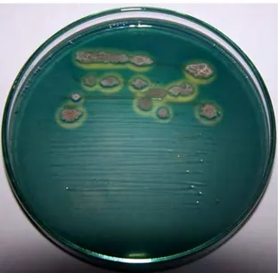 Gambar 9  Penampilan isolat Bacillus sp. Cr-79 pada media agar-agar CAS yang  memperlihatkan terbentuknya zona berwarna oranye di sekitar koloni   yang menunjukkan diproduksinya siderofor