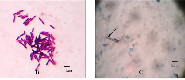 Gambar 1  Penampilan koloni isolat Bacillus sp. Cr 66 berumur 24 jam yang ditumbuhkan  pada media cawan gores Nutrien agar  (A);    (B) penampilan sel Bacillus sp