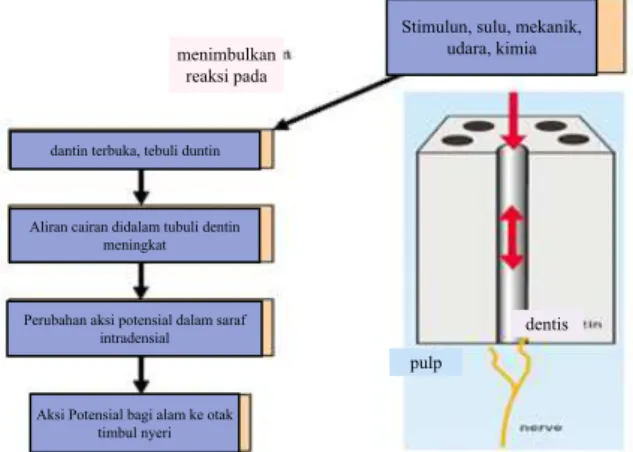 Gambar 1. Rasa nyeri akibat hipersensitivitas  dentin (Orchardson &amp; Gillam, 2006)