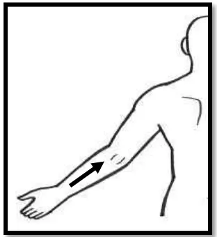 Gambar 2.2 Arah gerakan masase pada otot  triceps 
