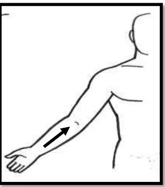 Gambar 2.6 Arah gerakan masase pada otot  biceps Sumber: Bambang Wijanarko, dkk. 2010