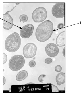 Gambar  10.  Gambar  sel  epithel  usus.  (A)  Sel  epithel normal/belum  terinfeksi  virus;(B)  Sel  epithel yang terinfeksi virus membesar membentuk “Giant cell”.