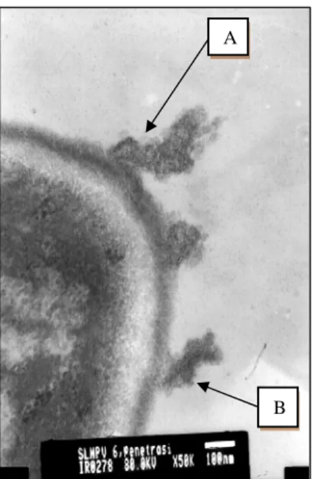 Gambar 11.  Pengenalan  multiple  nucleocapsid pada  membran  sel  ephitel  usus  larva  S