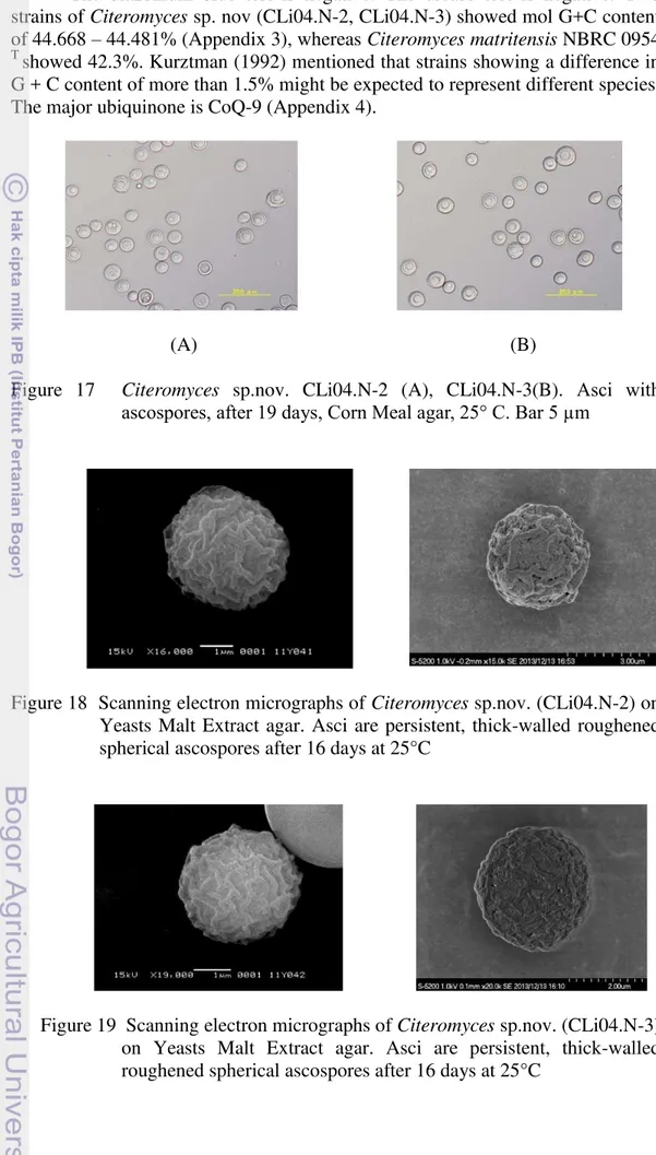 Figure  17    Citeromyces  sp.nov.  CLi04.N-2  (A),  CLi04.N-3(B).  Asci  with  ascospores, after 1λ days, Corn Meal agar, 25° C