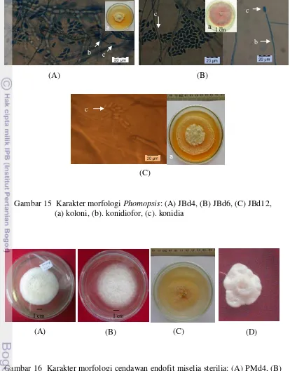 Gambar 15  Karakter morfologi Phomopsis: (A) JBd4, (B) JBd6, (C) JBd12, 