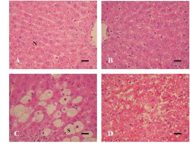 Gambar 3.  Gambaran histopatologi hati tikus yang diinduksi 0 ml CCl4    (kontrol, A), 0,1 ml CCl4/kg BB (B), 1,0 ml CCl4/kg BB (C), dan 10 ml CCl4/kg BB (D)