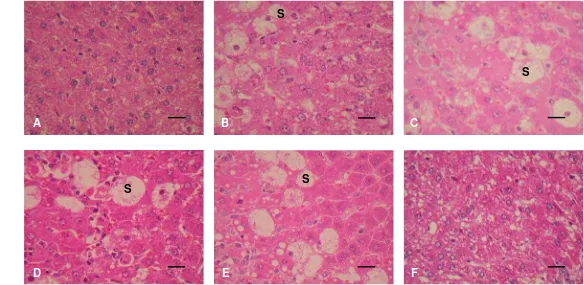 Gambar 4.  Gambaran histopatologi hati tikus pada kelompok silymarin (25 mg/kg BB), skor 1 (A), ekstrak metanol, skor 2 (B), fraksi n-heksan, skor 2 (C), fraksi kloroform, skor 3 (D), fraksi etil asetat, skor 3 (E), dan fraksi metanol-air, skor 1 (F) masin