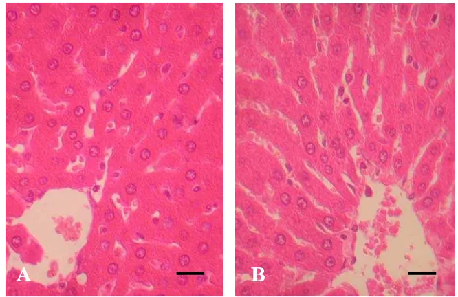 Gambar 7.  Gambaran histopatologi hati tikus pada kelompok air suling  2 ml/kg BB (A) dan fraksi metanol-air 1000 mg/kg BB (B) pada pengujian toksisitas subkronis