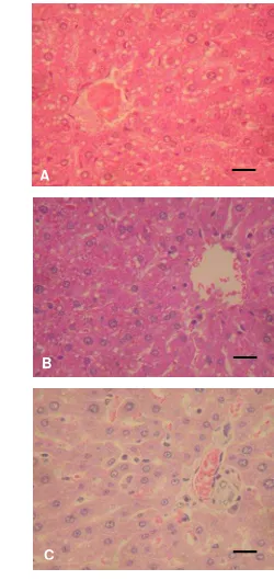 Gambar 8.  Gambaran histopatologi hati tikus pada kelompok air suling 2 ml/kg BB(A), silymarin 25 mg/kg BB (B), fraksi metanol-air 1000 mg/kg BB (C) yang ditantang dengan CCl4 dosis 0,1 ml/kg BB