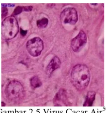 Gambar 2.5 Virus Cacar Air 50