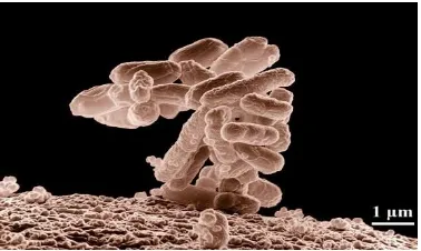 Gambar 2.2 Escherichia coli49 