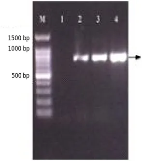 Figure 4. Visualization of DNA aiiA gene test isolates. Lane M: DNA marker 100 bp plus (Qiagen); lane 1 negative control; lane 2-4 DNA samples from isolates K4, B5, and S12.