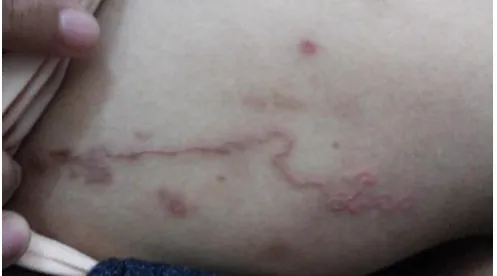 Gambar 1. Status Dermatologis Pasien 