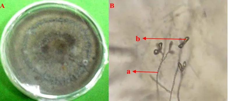 Gambar 8. Curvularia                  (B) konidiofor (a), konidia (b) sp koloni berumur 14  hari pada media PDA (A) dan bentuk mikroskopik   
