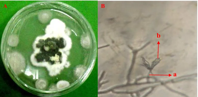 Gambar 11 Penicillium sp koloni berumur 14  hari pada media PDA (A) dan bentuk mikroskopik                    (B) konidiofor (a), konidia (b)  