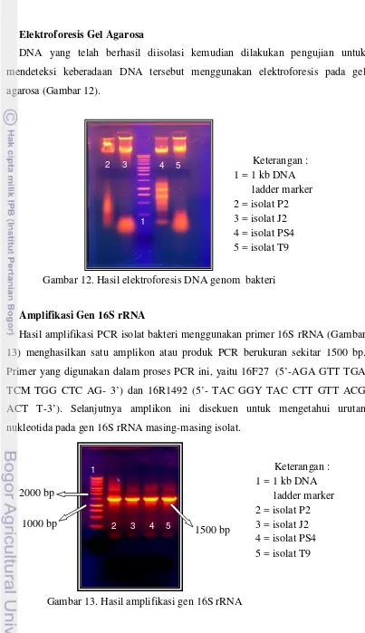Gambar 12. Hasil elektroforesis DNA genom  bakteri  