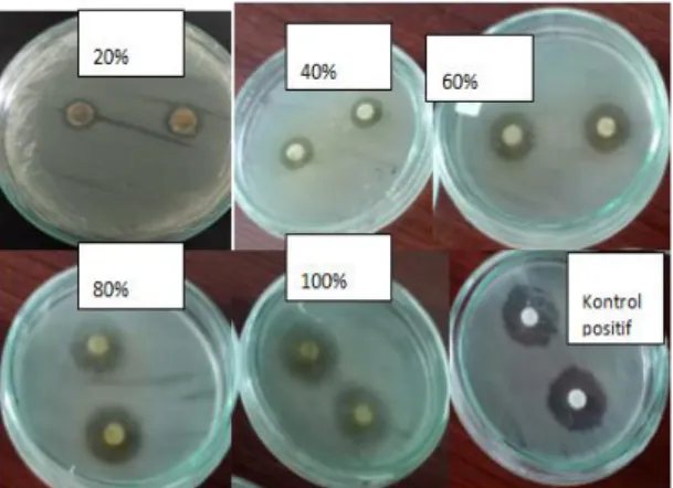 Gambar  2.  Zona  hambat  Ekstrak  uji  terhadap  pertumbuhan  bakteri Escherichia coli 
