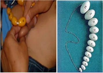 Gambar 4. Cara mengukur volume testis dengan orkidometer Prader