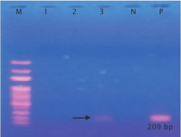 Gambar 3. Hasil amplifikasi DNA bakteri dengan PCR