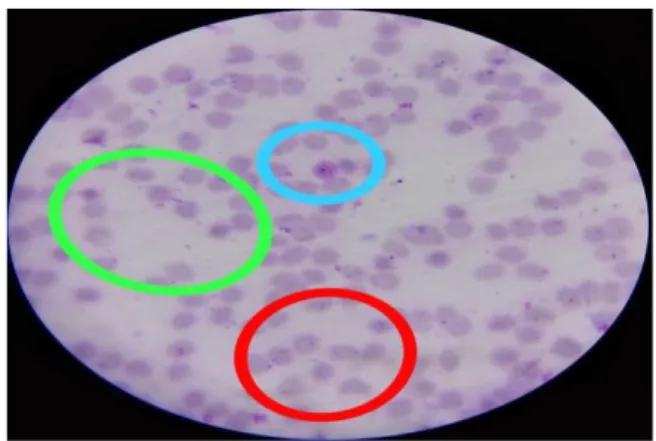 Gambar V. Hasil Pemeriksaan sediaan darah                       malaria dengan pH buffer 11    