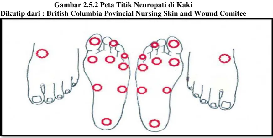Gambar 2.5.2 Peta Titik Neuropati di Kaki 