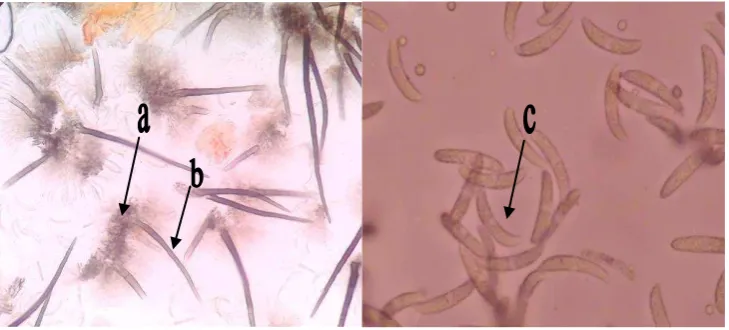 Gambar 1. (a) Aservulus (b) seta (c) konidia jamur C. capsici 