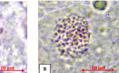 Gambar 2. Kromosom pada sel ujung akar planlet anggrek V. sumatrana Schltr.; A) Kontrol, B)  Hasil perlakuan 0,05% kolkisin selama 24 jam