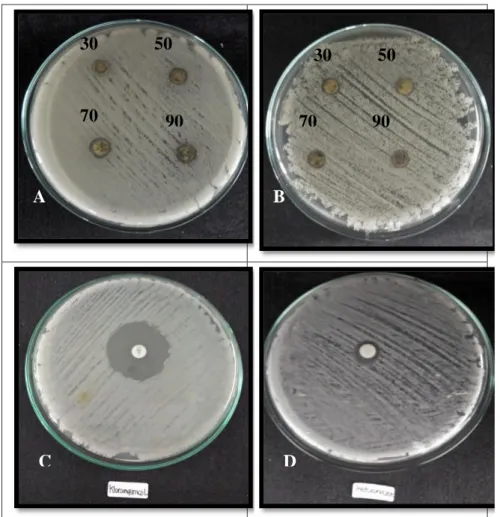 Gambar 4.2 Zona hambat ekstrak n-heksana daun surian dengan konsentrasi 90, 70,  50 dan 30 mg/mL terhadap pertumbuhan mikroba A