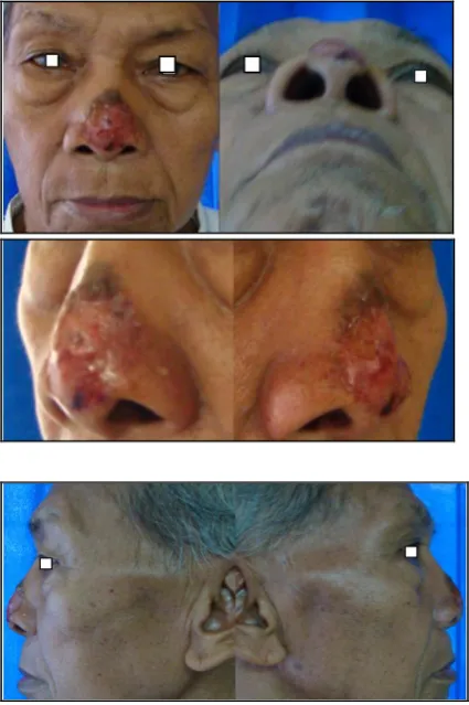 Figure 1. Before surgery 