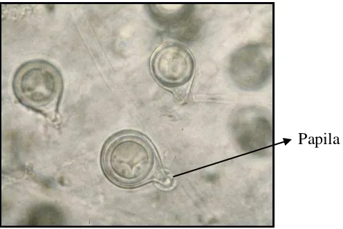 Gambar 2.  Spora jamur Phytophthora palmivora dengan tonjolan papila disalah        satu ujungnya (Sumber: Anonim, 2008) 